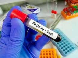 باقة  رويال لاب (تحليل نقص الحديد)